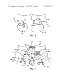 Decorative Toothpick Mold diagram and image