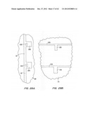 MICROFABRICATED ELASTOMERIC VALVE AND PUMP SYSTEMS diagram and image