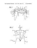 PROCESS FOR MAKING A DENTAL RESTORATION MODEL diagram and image