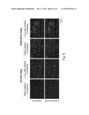 MOLECULAR MARKER FOR EVALUATING PATHOLOGICAL CONDITIONS AND TREATMENT OF     MUSCULAR DYSTROPHY diagram and image