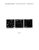 METHOD AND FOR THE DETECTION OF BIOLOGICAL MOLECULES USING A TWO PARTICLE     COMPLEX diagram and image