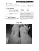 Methods of use of skin wound healing compositions diagram and image