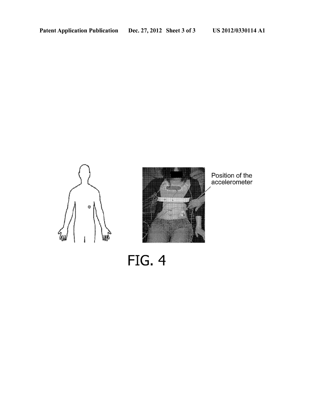 SYSTEM AND METHOD FOR OBTAINING AN OBJECTIVE MEASURE OF DYSPNEA - diagram, schematic, and image 04