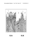 NONSURGICAL DETERMINATION OF ORGAN TRANSPLANT CONDITION diagram and image