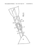 MEDICAL DEVICE AND TECHNIQUE FOR USING THE SAME diagram and image