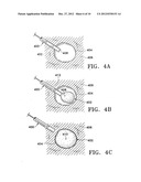 SUBCUTANEOUS CAVITY MARKING DEVICE AND METHOD diagram and image