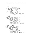 SUBCUTANEOUS CAVITY MARKING DEVICE AND METHOD diagram and image