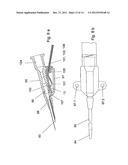 BLOOD VESSEL CATHETER AND INJECTION SYSTEM FOR CARRYING OUT A BLOOD     PRESSURE MEASUREMENT OF A PATIENT diagram and image