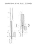 Intramedullary Rod Tracking diagram and image