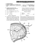 Methods and Apparatus for Removing Blood Clots and Tissue from the     Patient s Head diagram and image