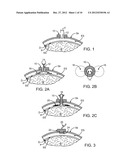 Methods and Apparatus for Removing Blood Clots and Tissue from the     Patient s Head diagram and image