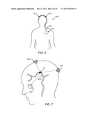 Methods and Apparatus for Removing Blood Clots and Tissue from the     Patient s Head diagram and image