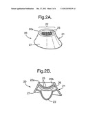 IRRADIATION DEVICE diagram and image