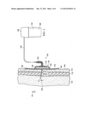 REDUCED-PRESSURE DRESSINGS EMPLOYING TISSUE-FIXATION ELEMENTS diagram and image