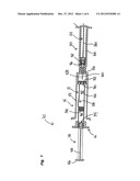 Airless mixing with a by-pass syringe diagram and image