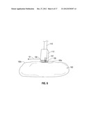 Shaped Electrode Bipolar Resection Apparatus, System and Methods of Use diagram and image