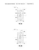 Shaped Electrode Bipolar Resection Apparatus, System and Methods of Use diagram and image