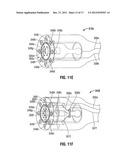 Shaped Electrode Bipolar Resection Apparatus, System and Methods of Use diagram and image