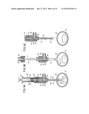 BONE CEMENT INJECTION PUNCTURE NEEDLE diagram and image