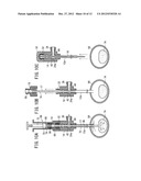 BONE CEMENT INJECTION PUNCTURE NEEDLE diagram and image