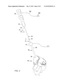 TRANSAPICAL CLOSURE DEVICES AND METHODS FOR USE diagram and image