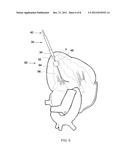 TRANSAPICAL CLOSURE DEVICES AND METHODS FOR USE diagram and image