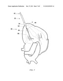 TRANSAPICAL CLOSURE DEVICES AND METHODS FOR USE diagram and image