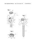 BONE ANCHORING DEVICE diagram and image