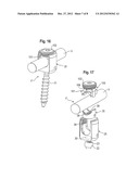 BONE ANCHORING DEVICE diagram and image