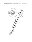 CLOSED BAND FOR PERCUTANEOUS ANNULOPLASTY diagram and image