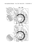 CLOSED BAND FOR PERCUTANEOUS ANNULOPLASTY diagram and image