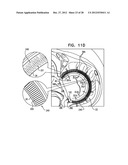 CLOSED BAND FOR PERCUTANEOUS ANNULOPLASTY diagram and image