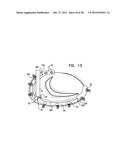 CLOSED BAND FOR PERCUTANEOUS ANNULOPLASTY diagram and image