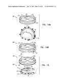 CLOSED BAND FOR PERCUTANEOUS ANNULOPLASTY diagram and image