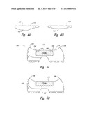 SHOE ASSEMBLY WITH NON-LINEAR VISCOUS LIQUID diagram and image