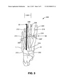 Bowling Shoe Outsole With Interchangeable Pads diagram and image