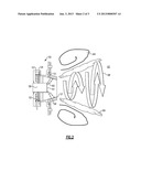 SWIRLER FOR GAS TURBINE ENGINE FUEL INJECTOR diagram and image