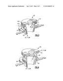 SWIRLER FOR GAS TURBINE ENGINE FUEL INJECTOR diagram and image