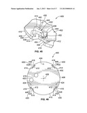 Pressure Gage with Removable Housing and Helix diagram and image