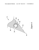 DEVICES AND METHODS FOR ABLUMINALLY COATING MEDICAL DEVICES diagram and image