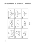 BACKUP KIT FOR A PATIENT-SPECIFIC ARTHROPLASTY KIT ASSEMBLY diagram and image