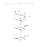 METHOD OF REDUCING RIGIDITY OF ANGIOPLASTY BALLOON SECTIONS diagram and image