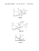 METHOD OF REDUCING RIGIDITY OF ANGIOPLASTY BALLOON SECTIONS diagram and image