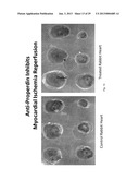 HUMANIZED AND CHIMERIC ANTI-PROPERDIN ANTIBODIES diagram and image