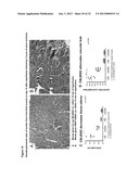 METHODS FOR TREATING REPERFUSION INJURIES diagram and image