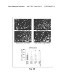 DISC-1 PATHWAY ACTIVATORS IN THE CONTROL OF NEUROGENESIS diagram and image