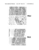 HYDROGEL OF MICROSPHERES diagram and image