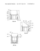 System and Method fo Dental Implant and Interface to Abutment For     Restoration diagram and image