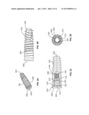 Dental Implant and Abutment Tools diagram and image