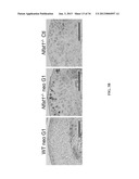 PREVENTION AND TREATMENT OF OSTEOARTHRITIS diagram and image